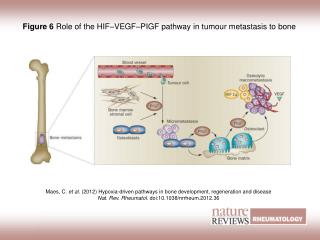 Figure 6 Role of the HIF–VEGF–PIGF pathway in tumour metastasis to bone