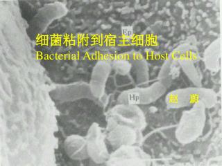 细菌粘附到宿主细胞 Bacterial Adhesion to Host Cells