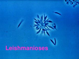 Leishmanioses