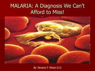 MALARIA: A Diagnosis We Can’t Afford to Miss!