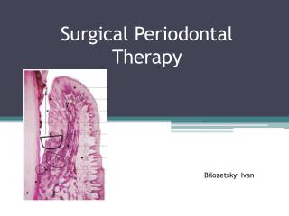 Surgical Periodontal Therapy