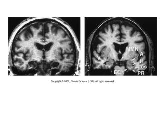 Trisynaptic Circuit