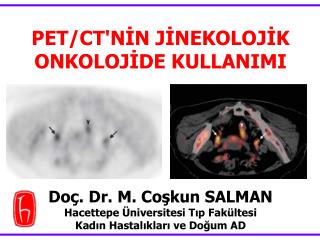 PET/CT'NİN JİNEKOLOJİK ONKOLOJİDE KULLANIMI