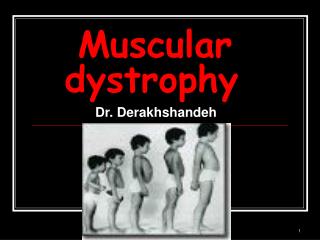 Muscular dystrophy