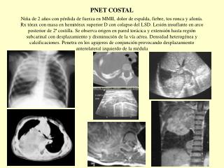 3._pnet_costal