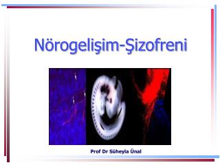 Nörogelişim -Şizofreni