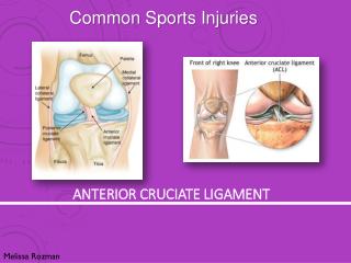 Anterior Cruciate Ligament