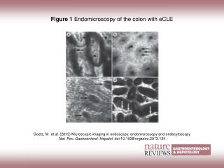 Figure 1 Endomicroscopy of the colon with eCLE