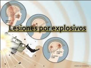 Lesiones por explosivos