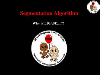What is LIGASE….?!