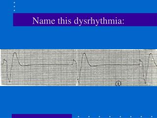 Name this dysrhythmia: