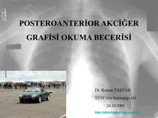 POSTEROANTERİOR AKCİĞER GRAFİSİ OKUMA BECERİSİ