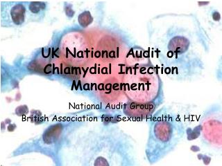 UK National Audit of Chlamydial Infection Management