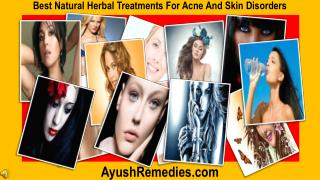 Best Natural Herbal Treatments For Acne And Skin Disorders