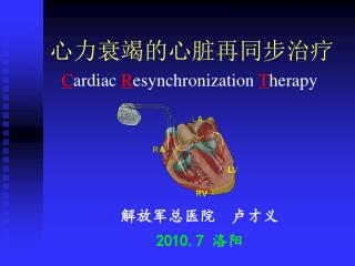 心力衰竭的心脏再同步治疗 C ardiac R esynchronization T herapy