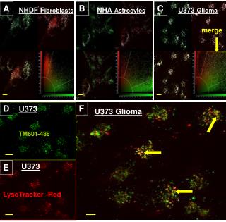 NHA Astrocytes