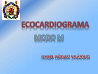 ECOCARDIOGRAMA