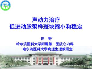 声动力治疗 促进动脉粥样斑块缩小和稳定