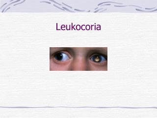 Leukocoria