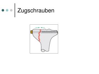 Zugschrauben