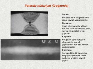 Yetersiz nüfuziyet (X-ağzında)
