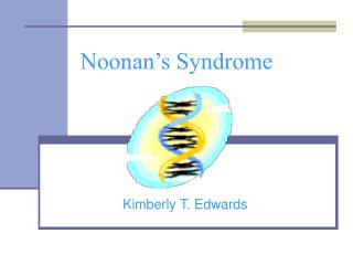 Noonan’s Syndrome