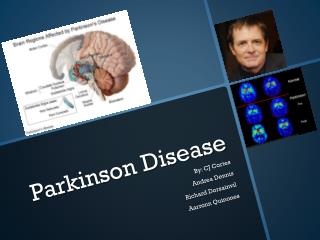 Parkinson Disease