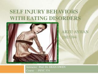 SELF INJURY BEHAVIORS WITH EATING DISORDERS Arzu Ayhan 				 1803394