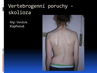 Vertebrogenní poruchy - skolioza