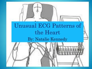 Unusual ECG Patterns of the Heart