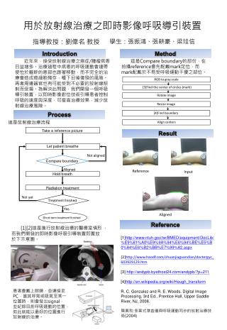 用於放射線治療之即時影像呼吸導 引 裝置