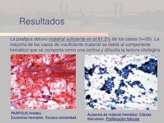 Resultados