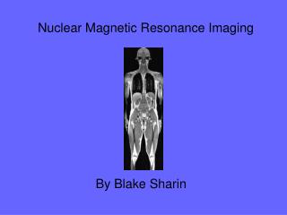 Nuclear Magnetic Resonance Imaging