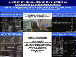 Clinical Presentation Women of 55 years. Chronic valvular disease left saphenous vein.