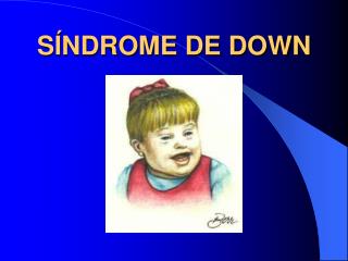 SÍNDROME DE DOWN