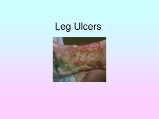 Leg Ulcers