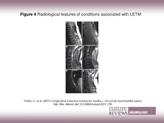 Figure 4 Radiological features of conditions associated with LETM