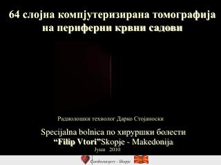 64 слојна компјутеризирана томографија на периферни крвни садови