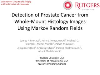 Detection of Prostate Cancer from Whole-Mount Histology Images Using Markov Random Fields