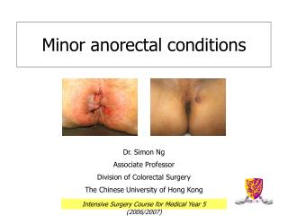 Minor anorectal conditions