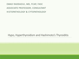 Hypo, Hyperthyroidism and Hashimoto’s Thyroiditis