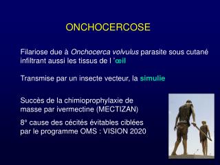 ONCHOCERCOSE