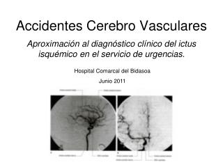 Accidentes Cerebro Vasculares