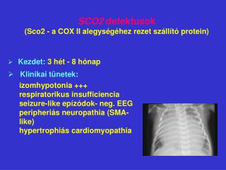 SCO2 defektusok (Sco2 - a COX II alegységéhez rezet szállító protein)