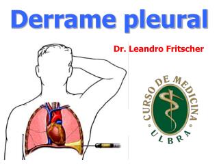 Derrame pleural