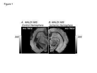 B. MALDI IMS Ischemic Hemisphere