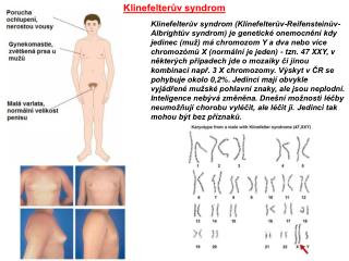 Klinefelterův syndrom