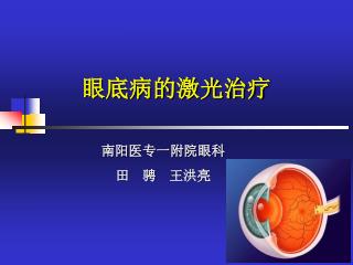 眼底病的激光治疗