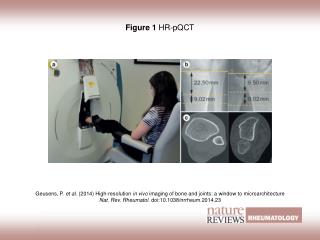 Figure 1 HR‑pQCT