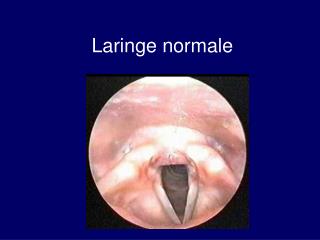 Laringe normale